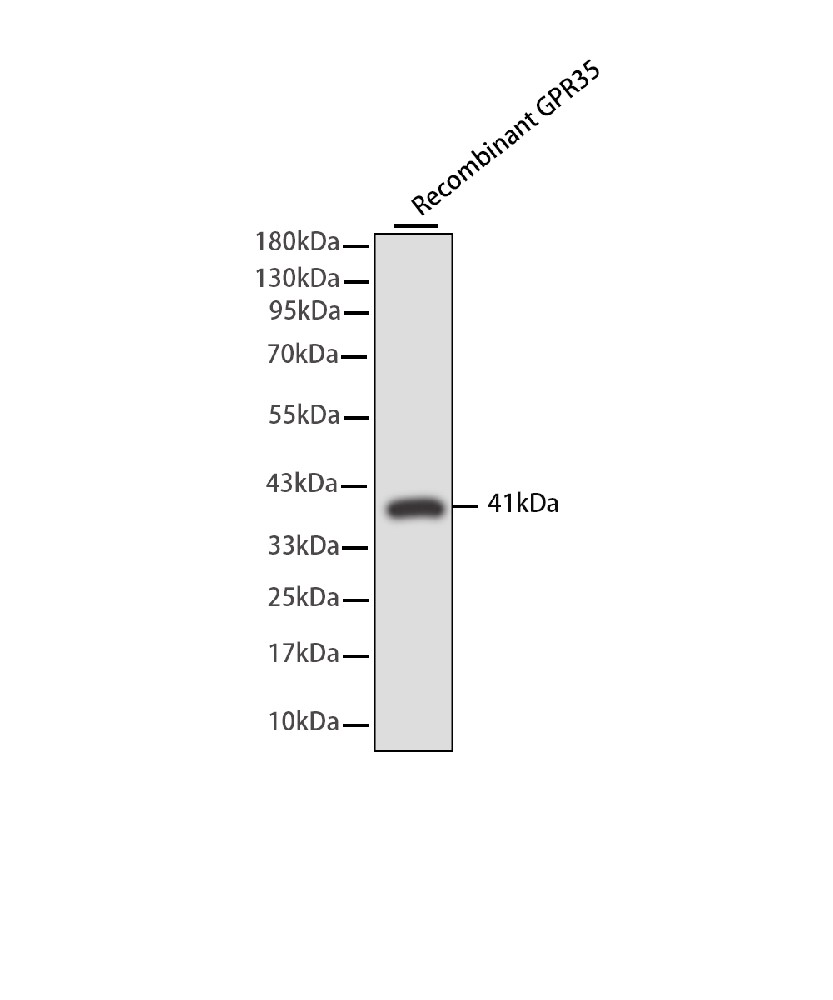 Mouse monoclonal antibody