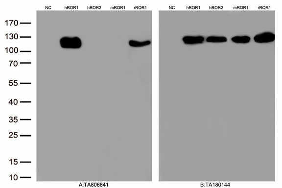 ROR1 Mouse mAb