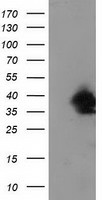 Mouse monoclonal antibody