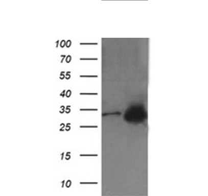 MMACHC Mouse mAb