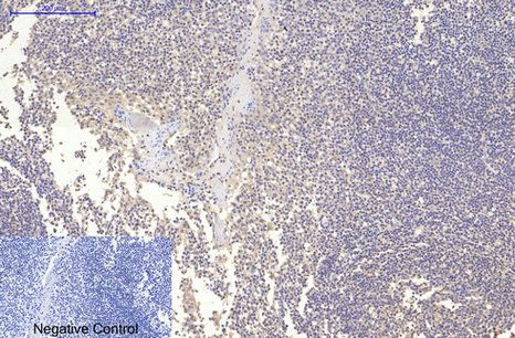 Mouse monoclonal antibody