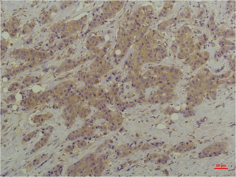 Mouse monoclonal antibody