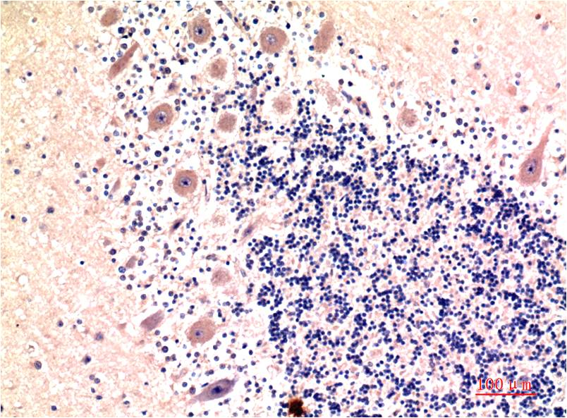 Mouse monoclonal antibody