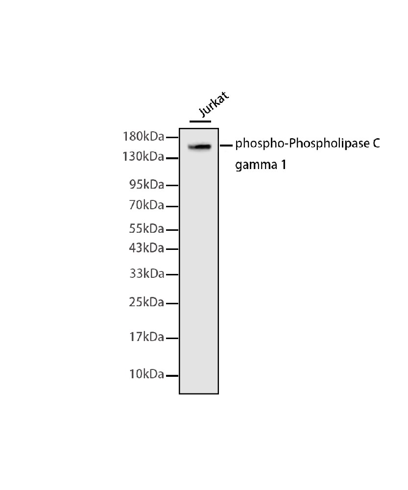 Rabbit monoclonal antibody