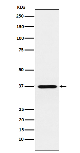 Rabbit monoclonal antibody