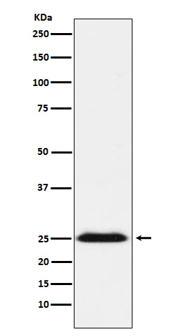 Rabbit monoclonal antibody