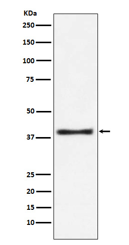 Rabbit monoclonal antibody