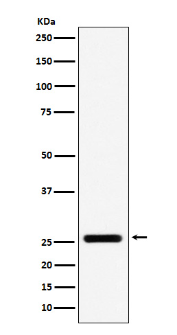 Rabbit monoclonal antibody