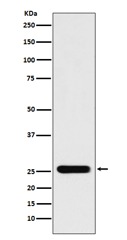 Rabbit monoclonal antibody