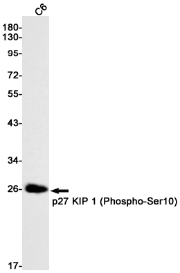 Rabbit monoclonal antibody
