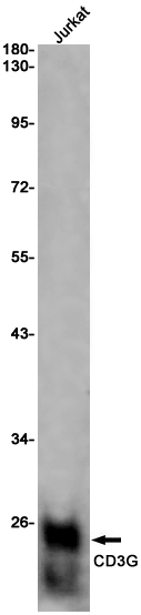 Rabbit monoclonal antibody
