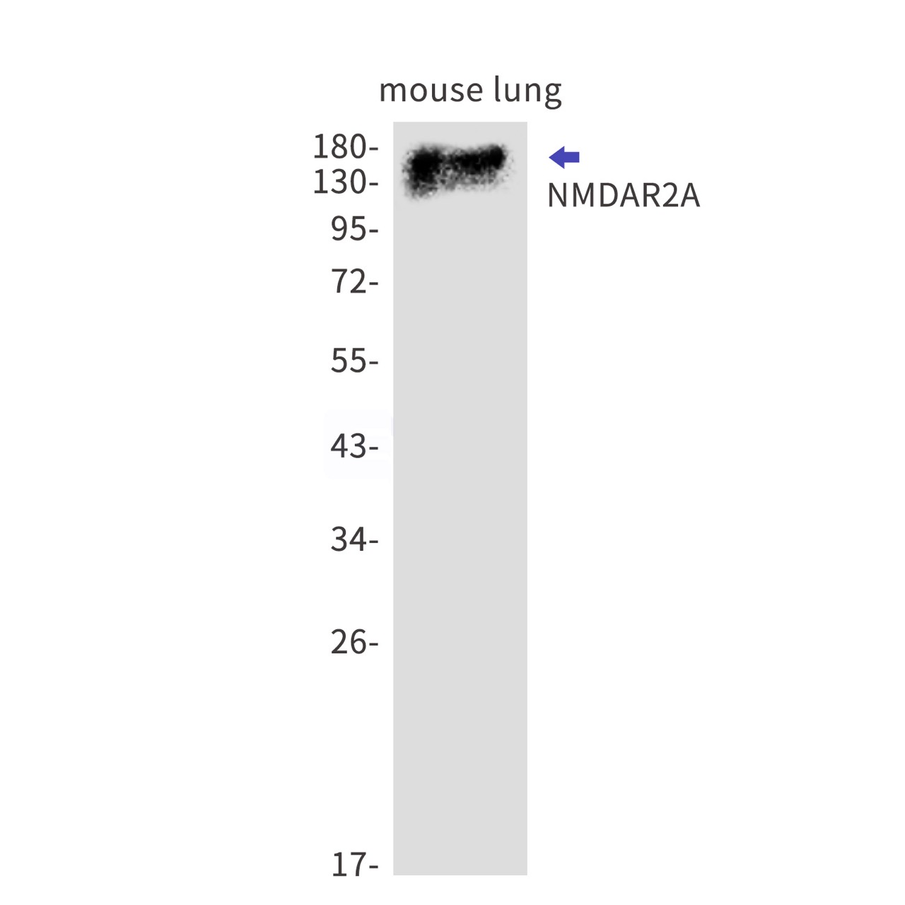 Rabbit monoclonal antibody