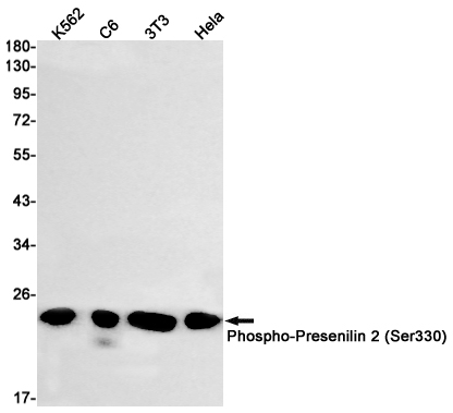 Rabbit monoclonal antibody