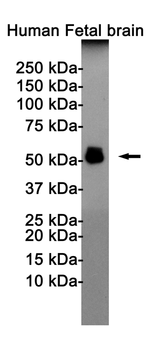 Rabbit monoclonal antibody