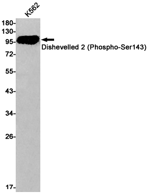 Rabbit monoclonal antibody