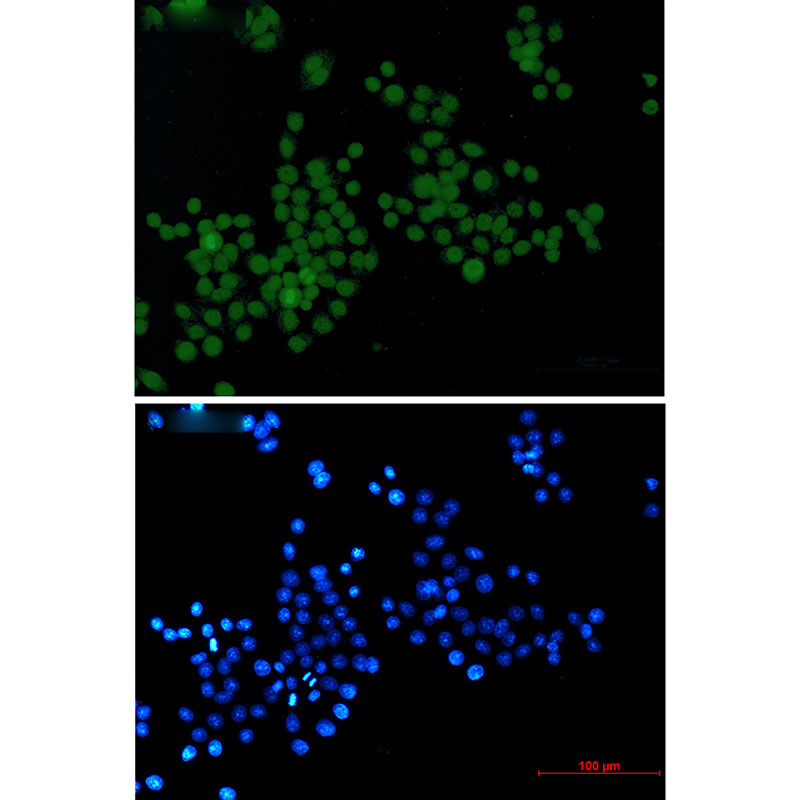 Rabbit monoclonal antibody