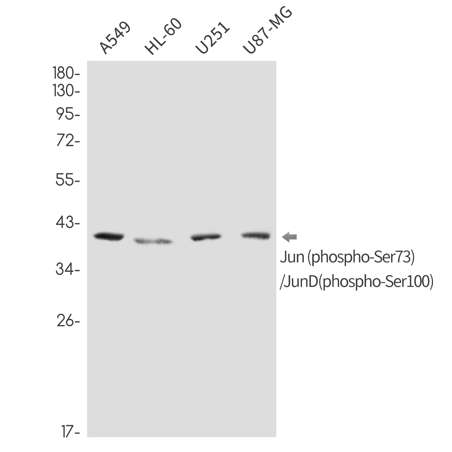 Rabbit monoclonal antibody
