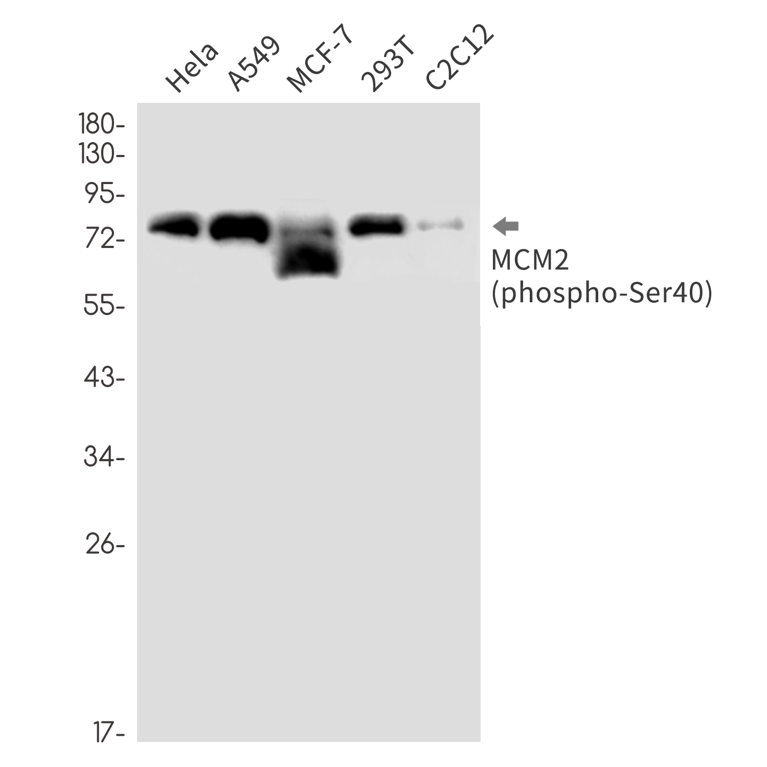 Rabbit monoclonal antibody