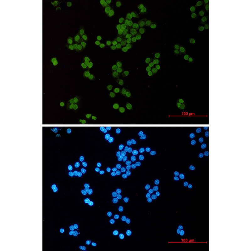 Rabbit monoclonal antibody