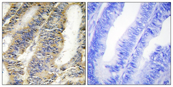 Rabbit monoclonal antibody