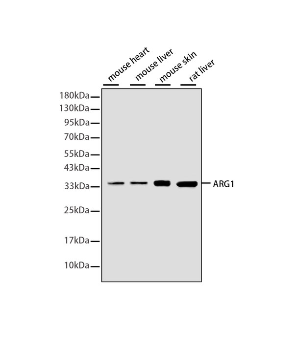 Rabbit monoclonal antibody