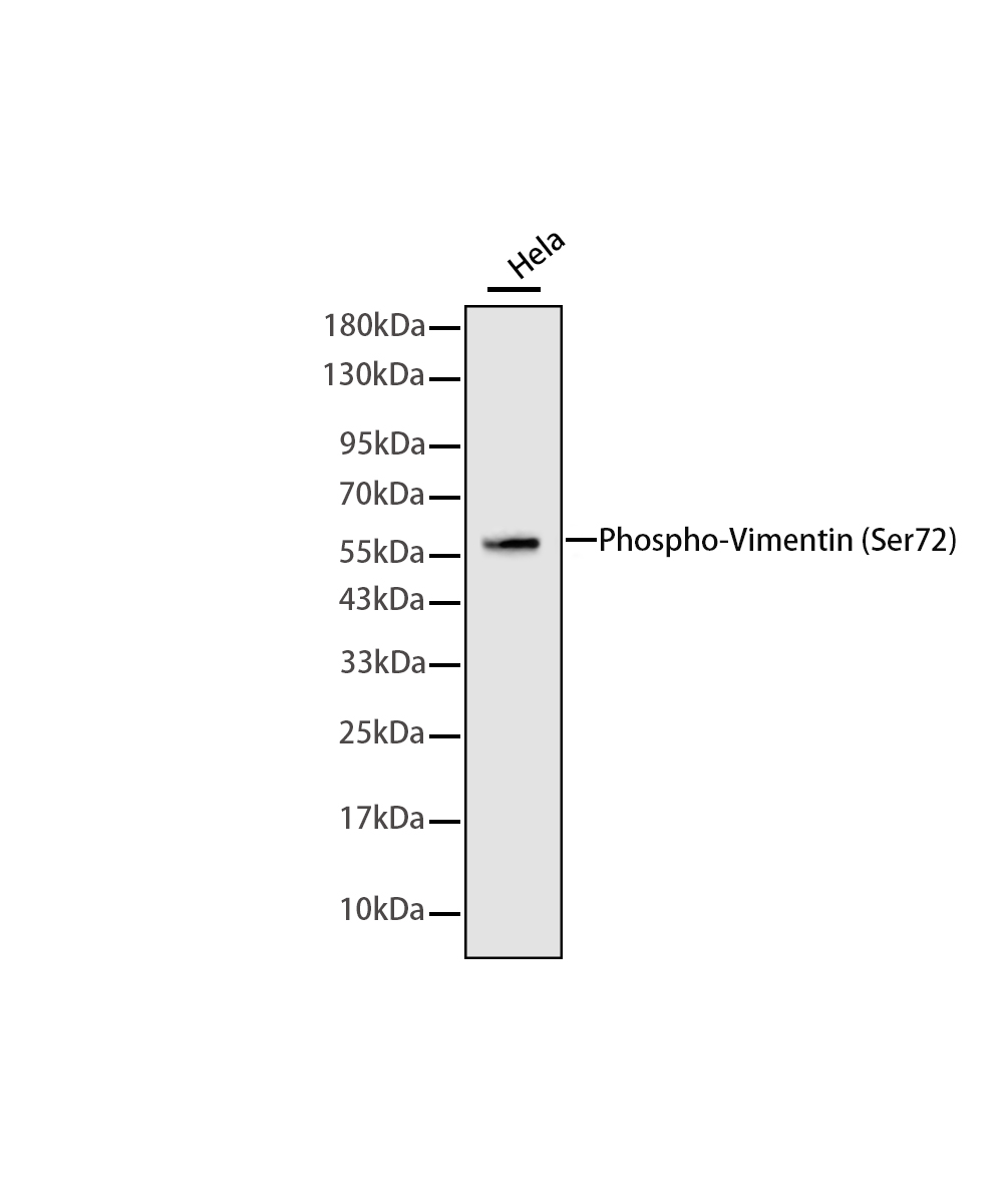 Rabbit monoclonal antibody