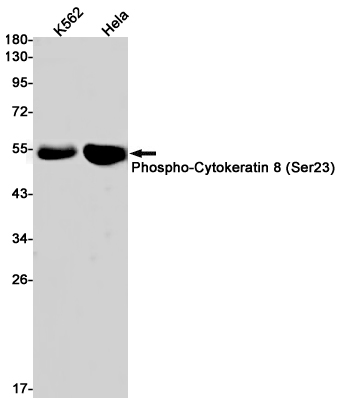 Rabbit monoclonal antibody