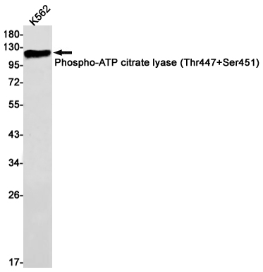 Rabbit monoclonal antibody