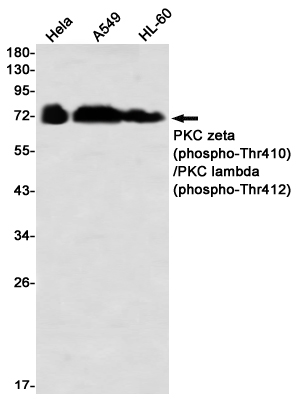 Rabbit monoclonal antibody