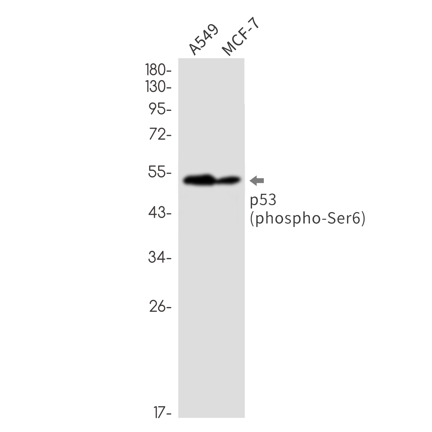 Rabbit monoclonal antibody