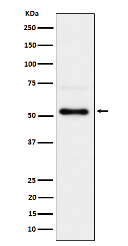 Rabbit monoclonal antibody