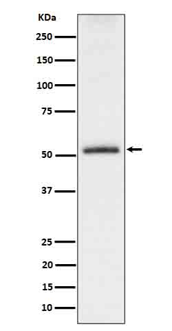 Phospho-Tau (S198) Rabbit mAb