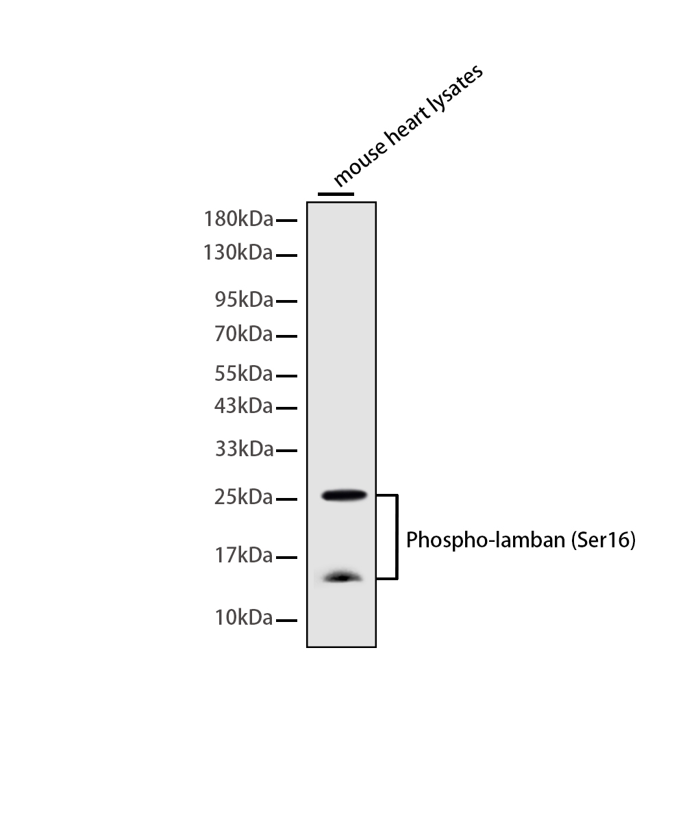 Rabbit monoclonal antibody