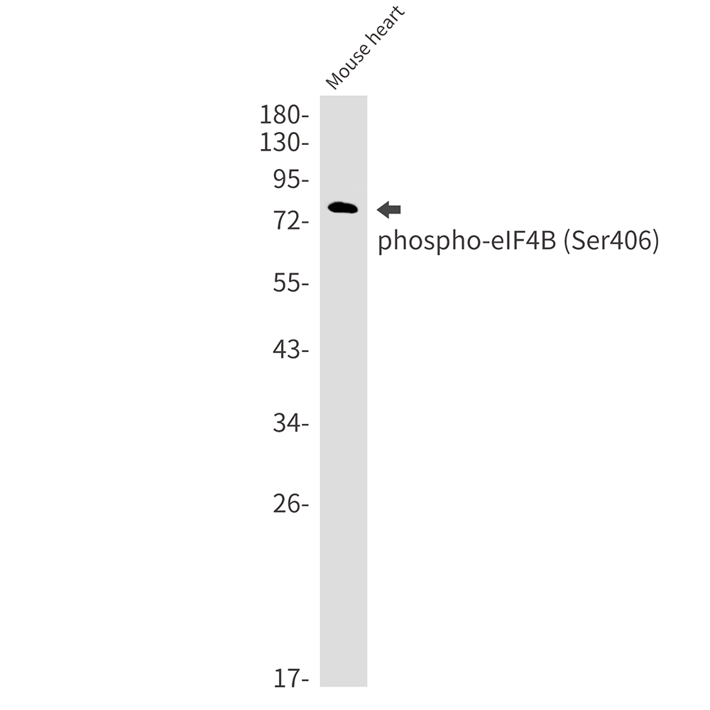 Rabbit monoclonal antibody