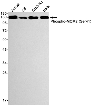 Rabbit monoclonal antibody