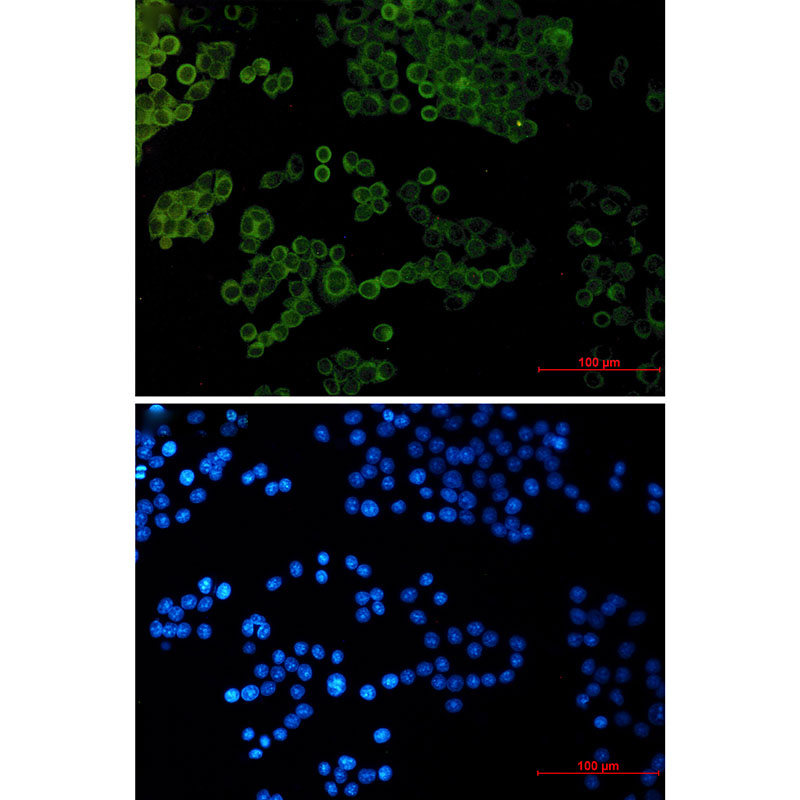 Rabbit monoclonal antibody