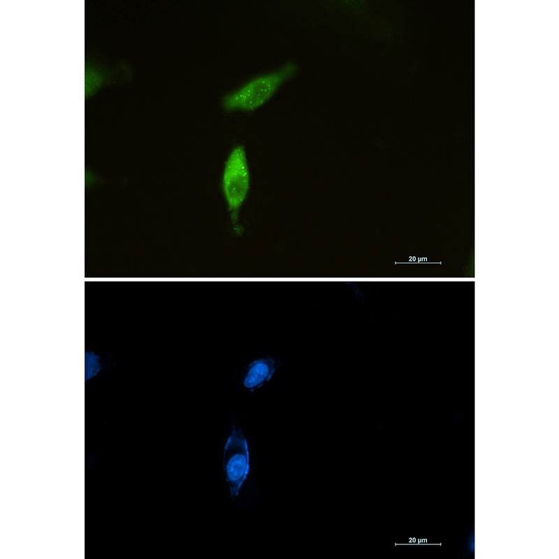 Rabbit monoclonal antibody