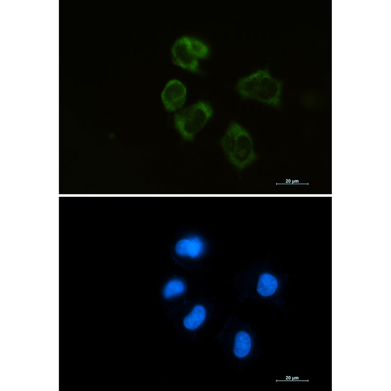 Rabbit monoclonal antibody