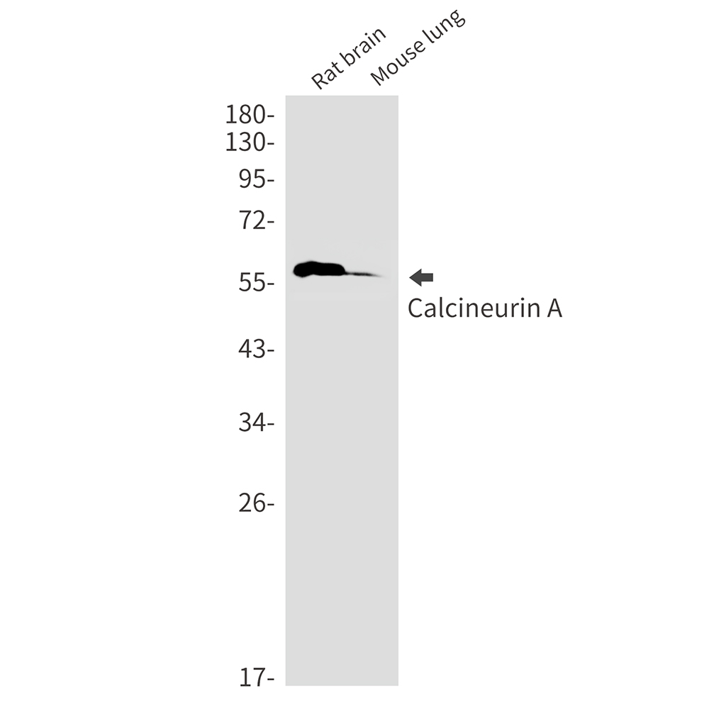 Rabbit monoclonal antibody
