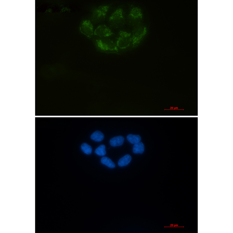 Rabbit monoclonal antibody