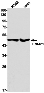 Rabbit monoclonal antibody