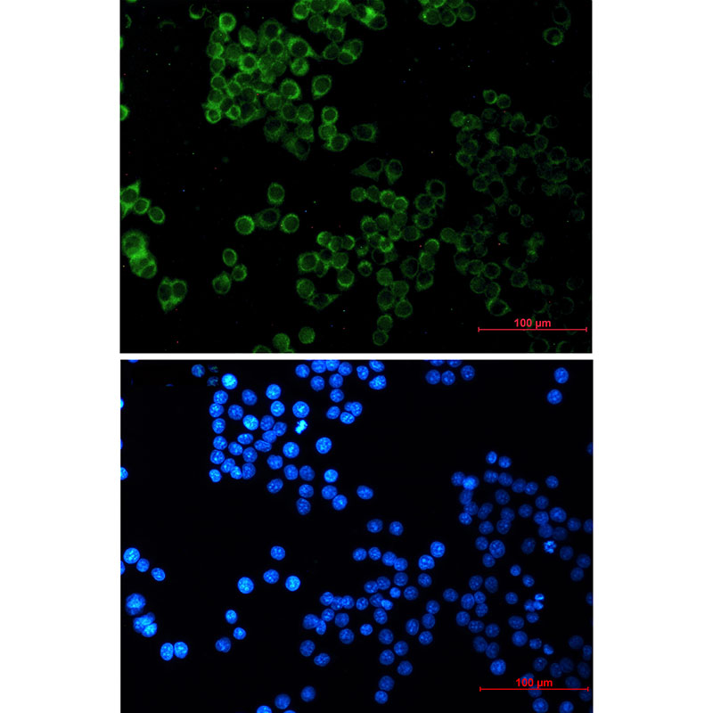 Rabbit monoclonal antibody