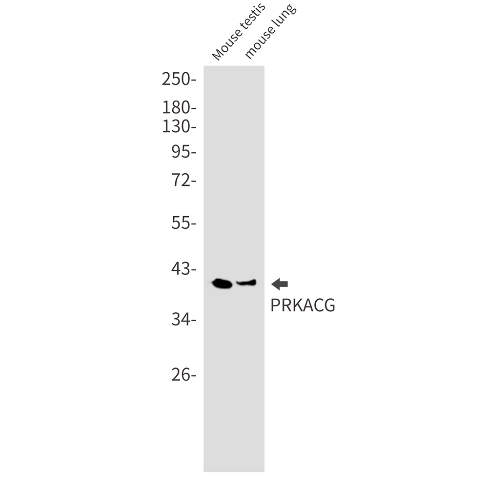 Rabbit monoclonal antibody