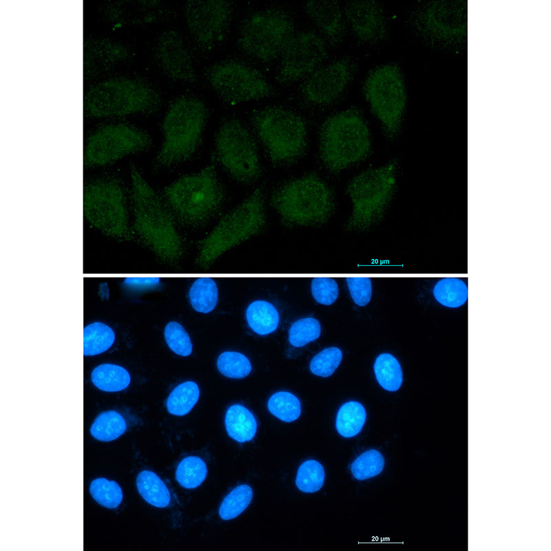 Rabbit monoclonal antibody