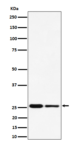 Rabbit monoclonal antibody
