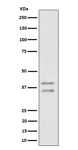 Rabbit monoclonal antibody