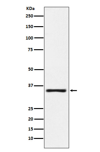 Rabbit monoclonal antibody