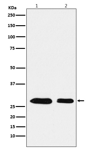 Rabbit monoclonal antibody