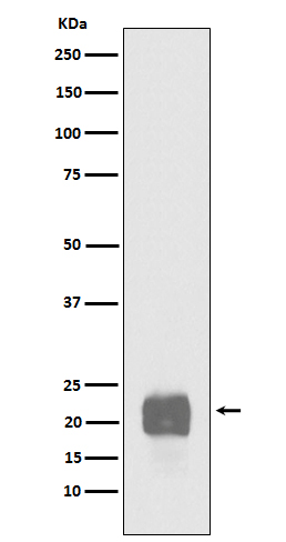 Rabbit monoclonal antibody