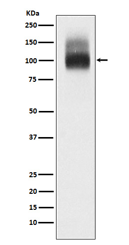 Rabbit monoclonal antibody